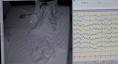 Klinik Nörofizyoloji Uzmanı Leba: "Uyku hastalığı kişinin ömrünü kısaltır"