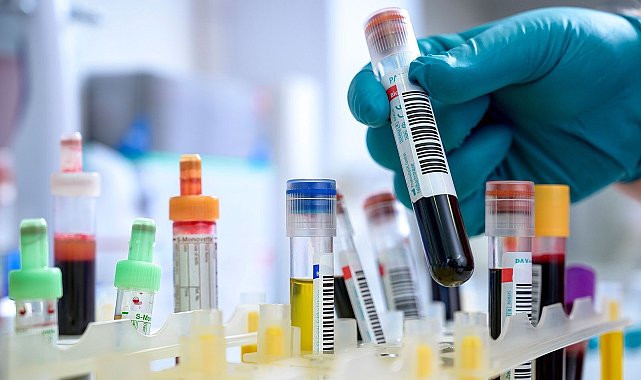 Demans ve ALS hastalarına umut olacak çalışma