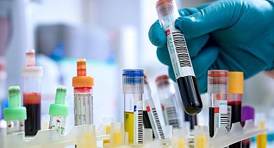 Demans ve ALS hastalarına umut olacak çalışma