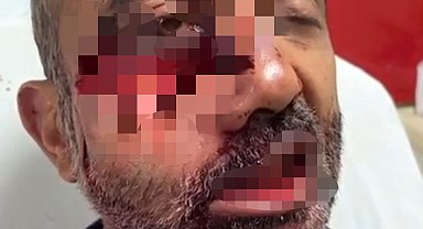 Hakkari'de tarlasına gitti iki ayının saldırısına uğradı