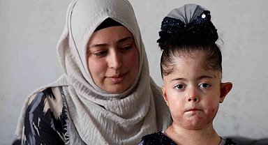 Kelebek hastası kızının tedavi masrafları için yardım bekliyor