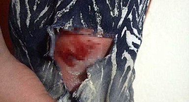 Elazığ'da başıboş köpeklerin kovaladığı şahıs yaralandı